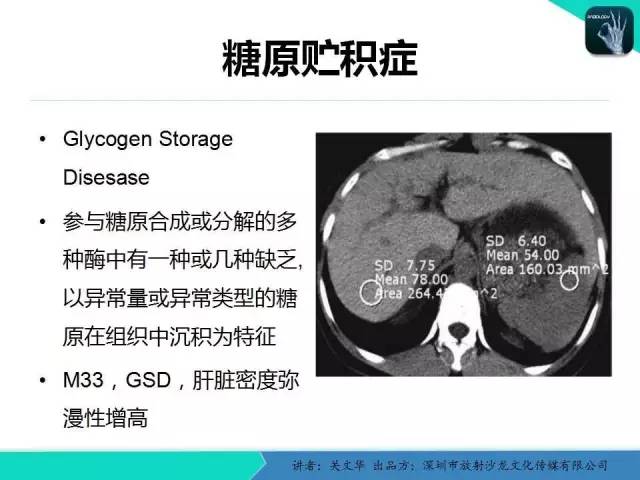 【PPT】精简版肝脏疾病的CT诊断