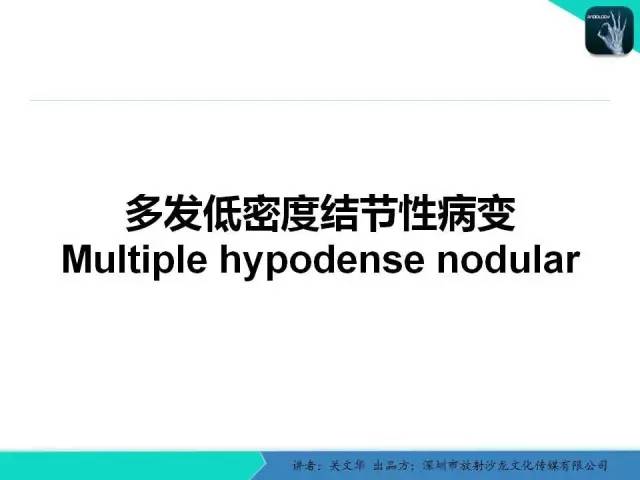 【PPT】精简版肝脏疾病的CT诊断
