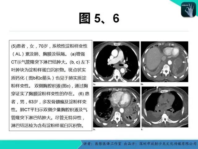 【PPT】淀粉样变性：现代断层成像