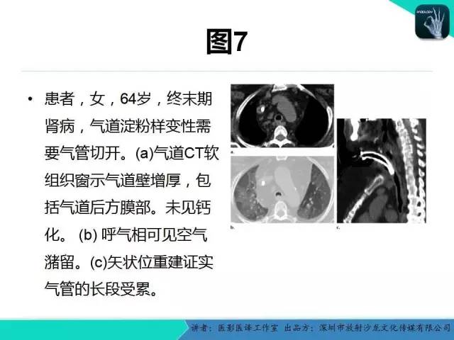 【PPT】淀粉样变性：现代断层成像