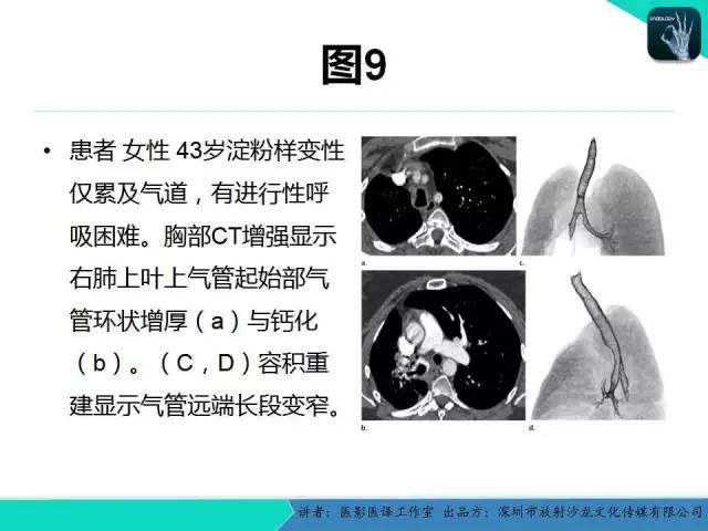 【PPT】淀粉样变性：现代断层成像