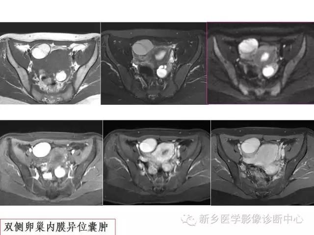 【PPT】卵巢的解剖和疾病诊断思路