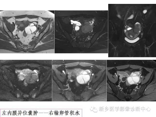 【PPT】卵巢的解剖和疾病诊断思路