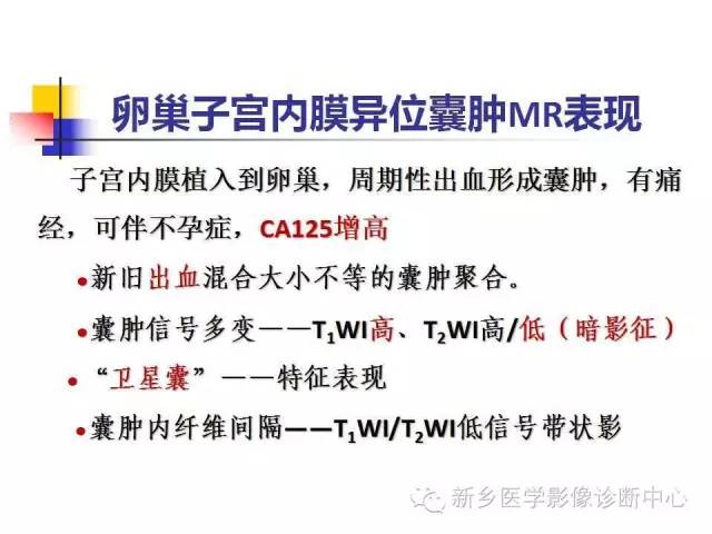 【PPT】卵巢的解剖和疾病诊断思路