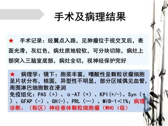 【病例】神经垂体颗粒细胞瘤1例MR影像表现