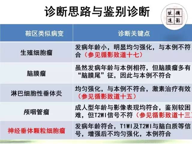 【病例】神经垂体颗粒细胞瘤1例MR影像表现