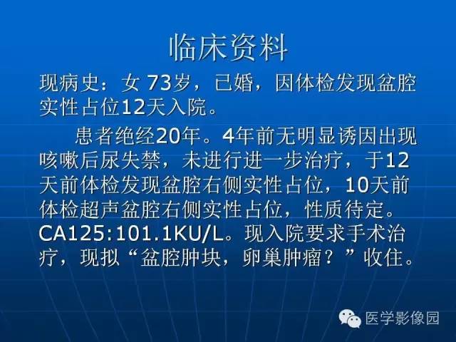 【病例】卵泡膜细胞瘤1例CT影像表现