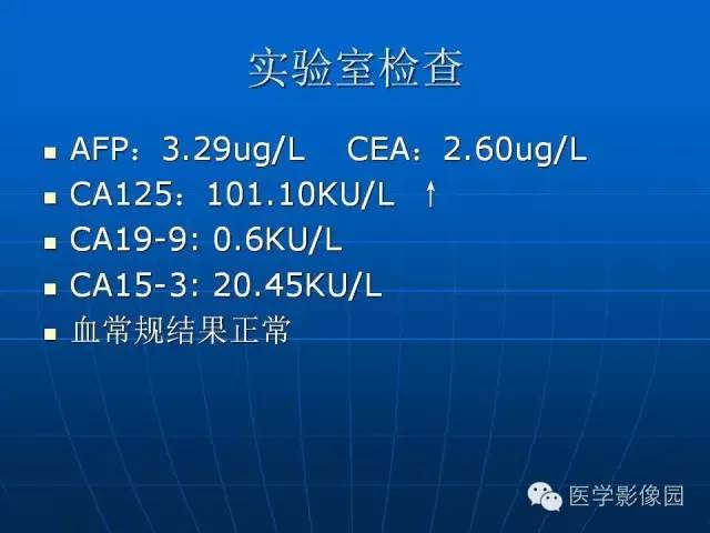 【病例】卵泡膜细胞瘤1例CT影像表现