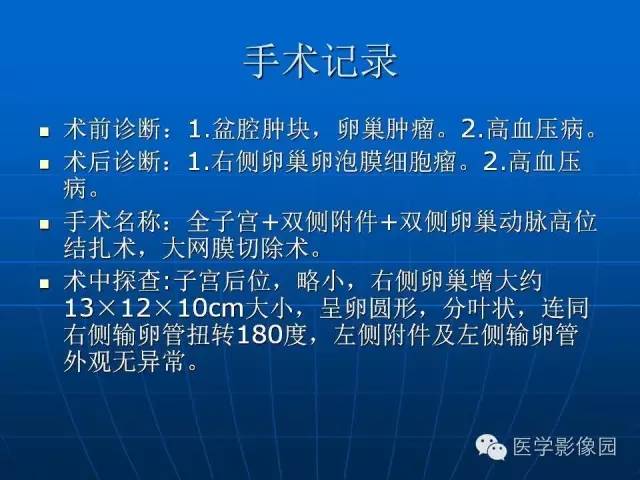 【病例】卵泡膜细胞瘤1例CT影像表现
