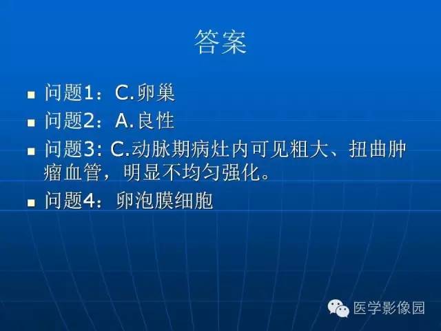 【病例】卵泡膜细胞瘤1例CT影像表现