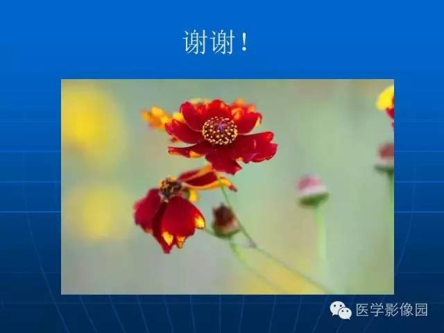 【病例】卵泡膜细胞瘤1例CT影像表现
