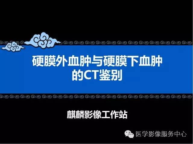 硬膜外血肿与硬膜下血肿的CT鉴别