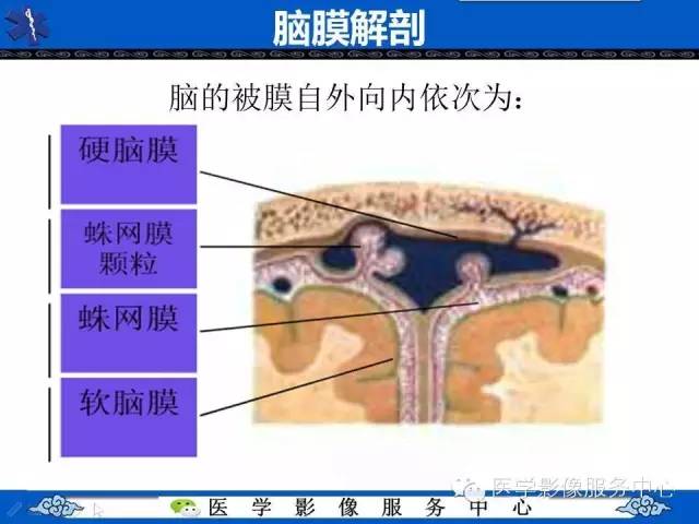 硬膜外血肿与硬膜下血肿的CT鉴别