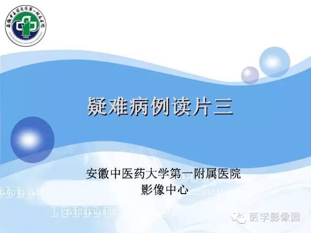 【病例】髂骨血管瘤1例影像表现