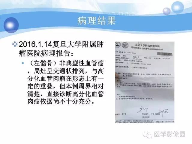 【病例】髂骨血管瘤1例影像表现