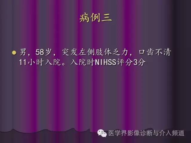 【PPT】联合应用DWI与DTI技术诊断缺血性小卒中及评估其预后