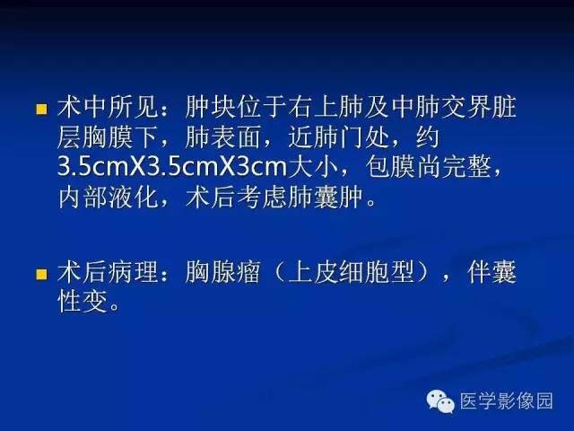 【病例】异位胸腺瘤1例CT影像表现