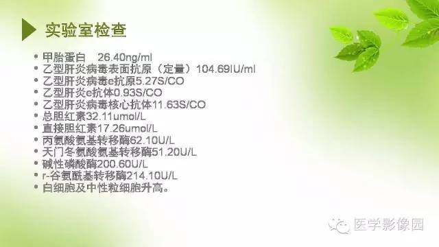 【病例】肝细胞性肝癌伴坏死1例CT影像表现