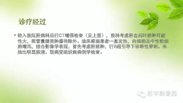 【病例】肝细胞性肝癌伴坏死1例CT影像表现