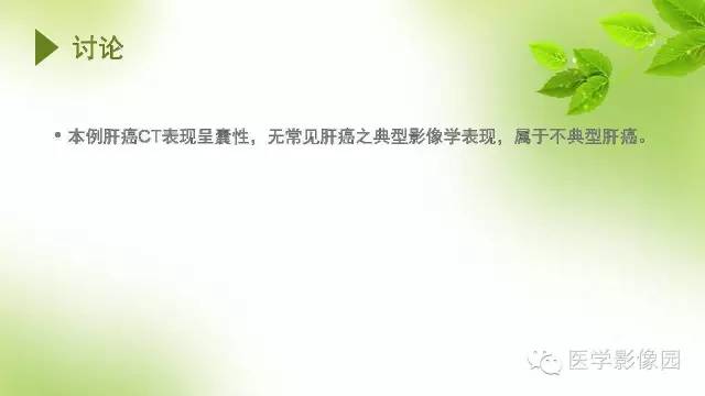 【病例】肝细胞性肝癌伴坏死1例CT影像表现