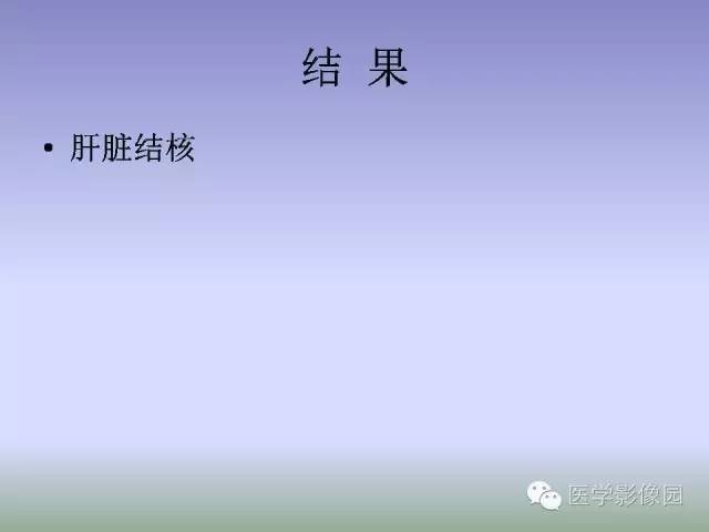 【病例】肝脏结核1例CT影像表现