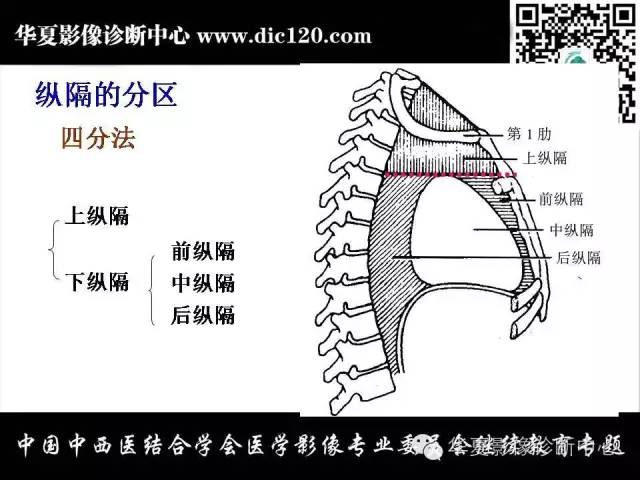 【PPT】纵隔疾病影像诊断和鉴别诊断