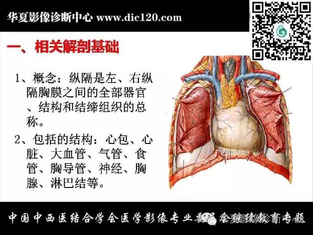 【PPT】纵隔疾病影像诊断和鉴别诊断