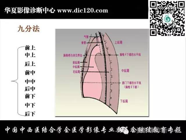 【PPT】纵隔疾病影像诊断和鉴别诊断