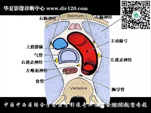 【PPT】纵隔疾病影像诊断和鉴别诊断