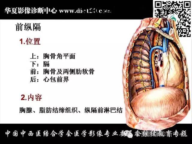 【PPT】纵隔疾病影像诊断和鉴别诊断