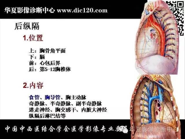 【PPT】纵隔疾病影像诊断和鉴别诊断