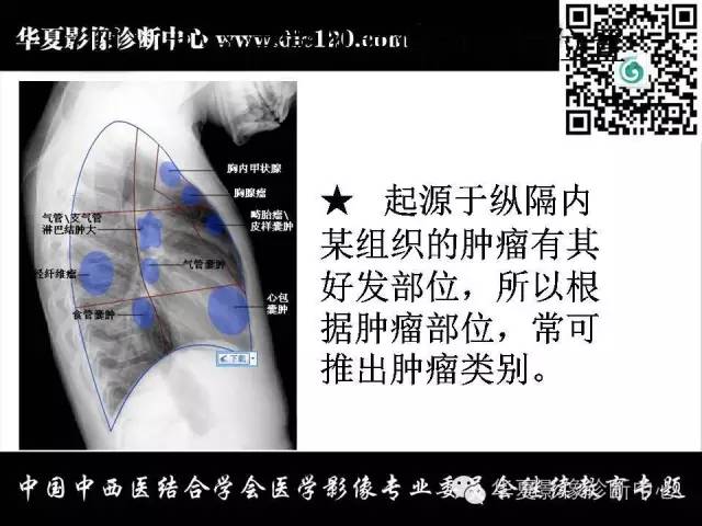 【PPT】纵隔疾病影像诊断和鉴别诊断