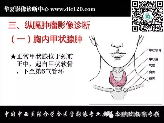 【PPT】纵隔疾病影像诊断和鉴别诊断