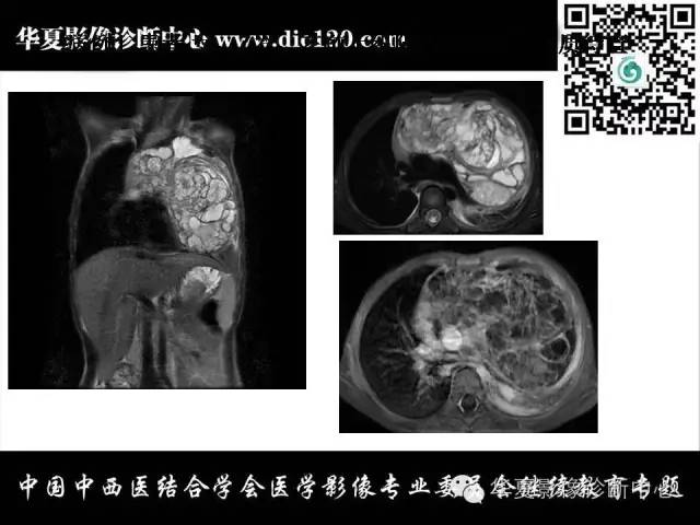 【PPT】纵隔疾病影像诊断和鉴别诊断