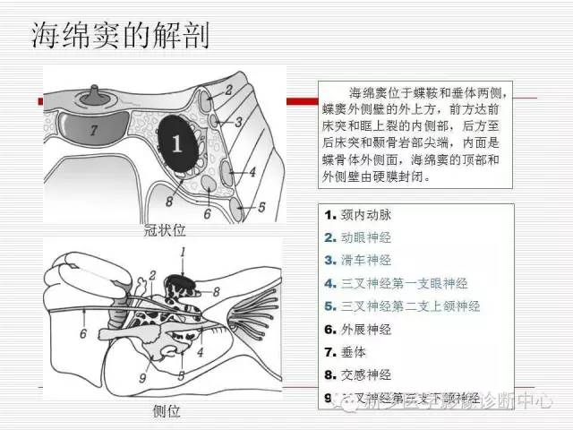 【PPT】引起海绵窦综合征的11种疾病