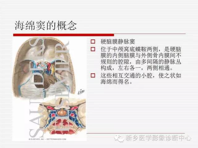 【PPT】引起海绵窦综合征的11种疾病