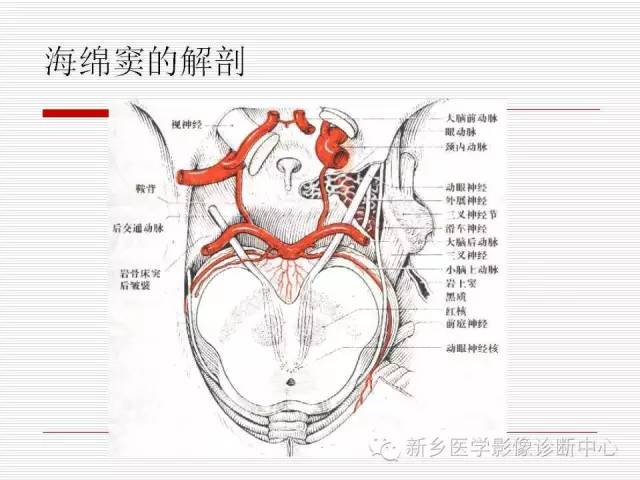 【PPT】引起海绵窦综合征的11种疾病