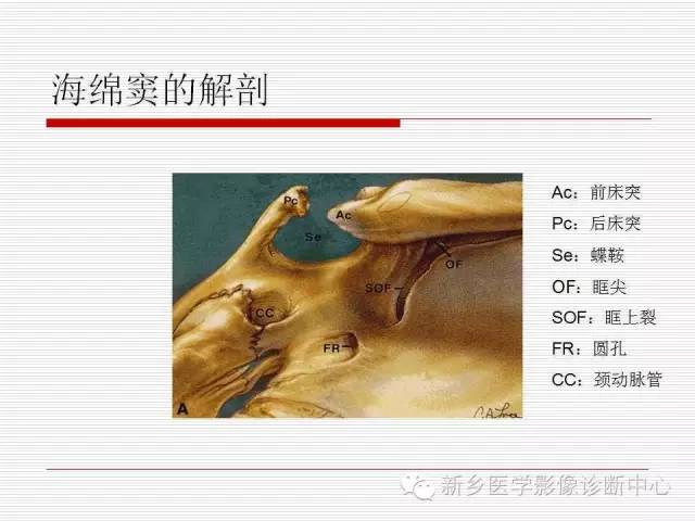 【PPT】引起海绵窦综合征的11种疾病