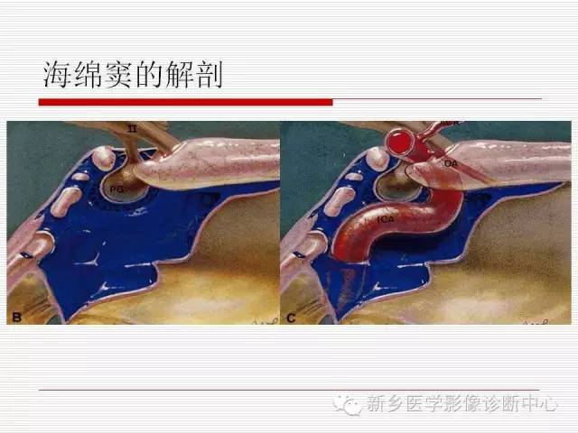 【PPT】引起海绵窦综合征的11种疾病