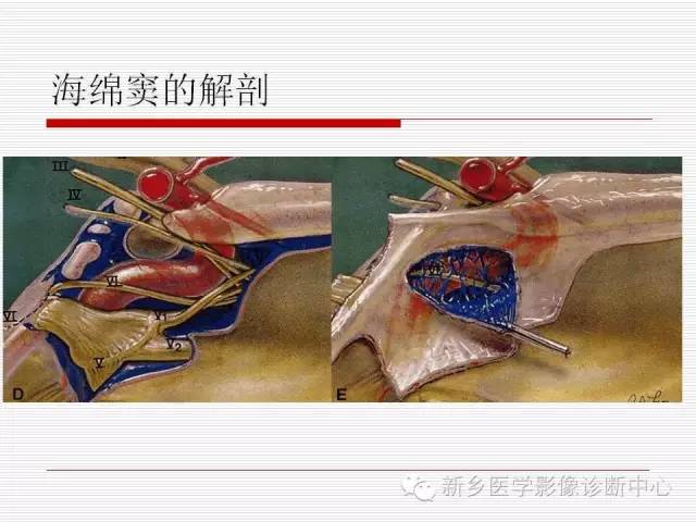 【PPT】引起海绵窦综合征的11种疾病