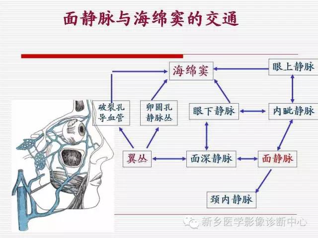 【PPT】引起海绵窦综合征的11种疾病
