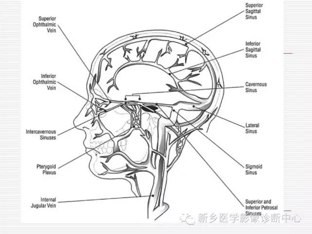 【PPT】引起海绵窦综合征的11种疾病