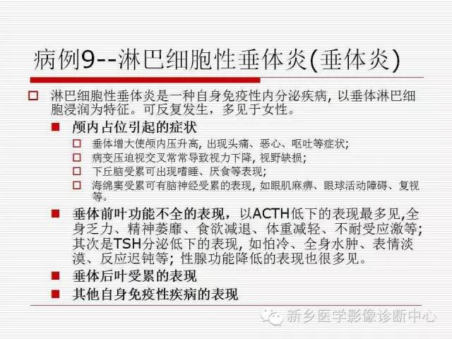【PPT】引起海绵窦综合征的11种疾病