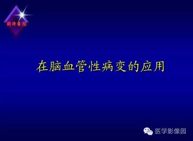 【PPT】MR磁敏感成像SWI原理及其在脑部的应用