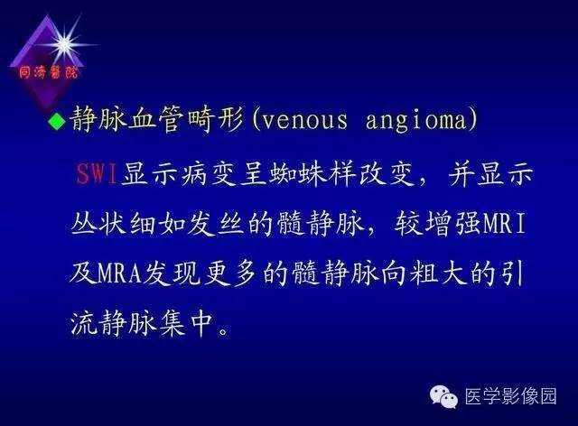 【PPT】MR磁敏感成像SWI原理及其在脑部的应用