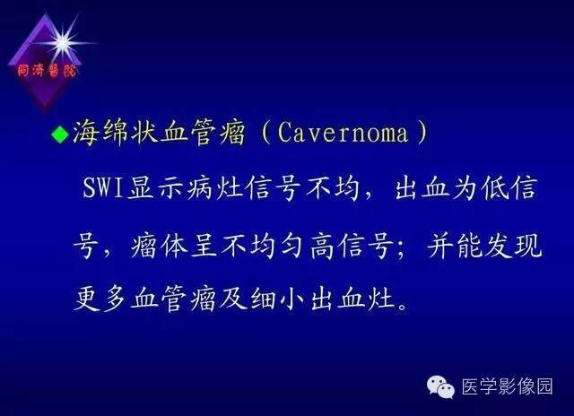 【PPT】MR磁敏感成像SWI原理及其在脑部的应用