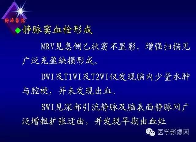 【PPT】MR磁敏感成像SWI原理及其在脑部的应用