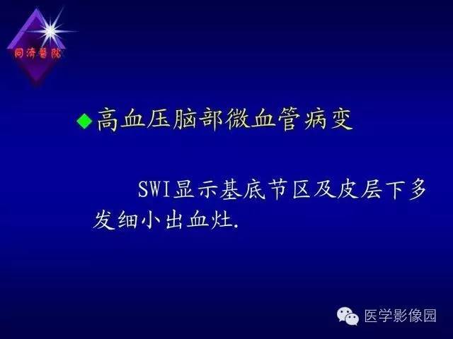 【PPT】MR磁敏感成像SWI原理及其在脑部的应用