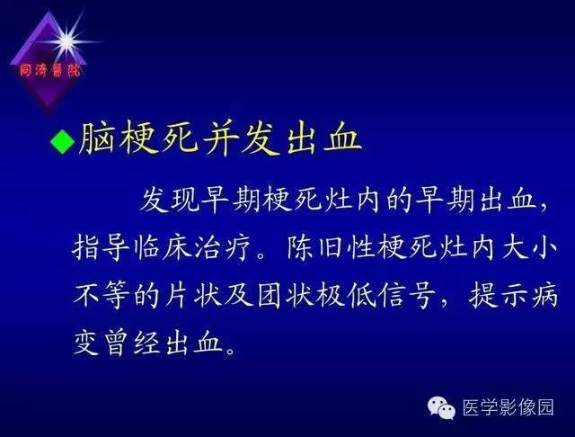 【PPT】MR磁敏感成像SWI原理及其在脑部的应用