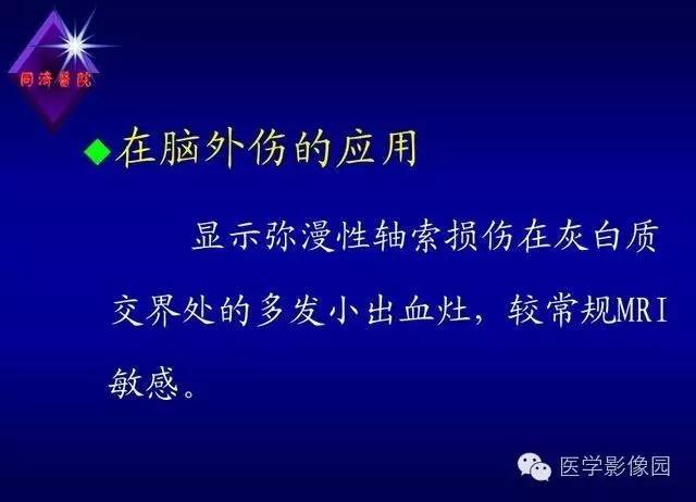 【PPT】MR磁敏感成像SWI原理及其在脑部的应用